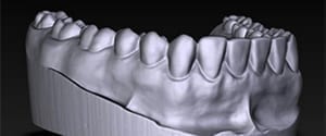 Medical Applications in 3D Scanning | LMI Technologies - Part 13