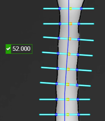Surface Track OK count